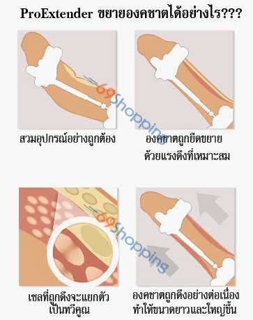 Proextender 3Rd เครื่องยืดขยายอวัยวะเพศชาย